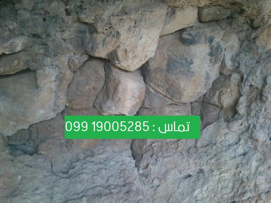 مزایای کتراک